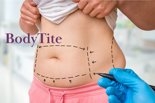 liposuction idaho falls