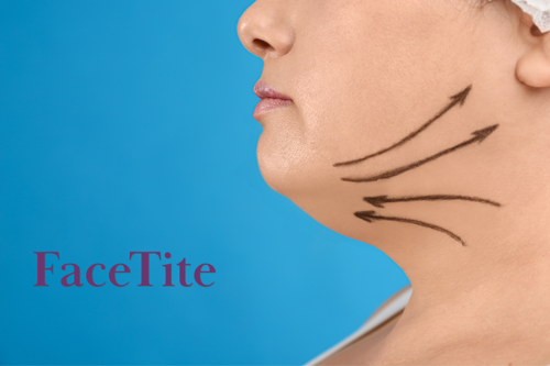 neck liposuction idaho falls